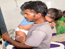 चमकी से अब तक 145 बच्चो की मौत