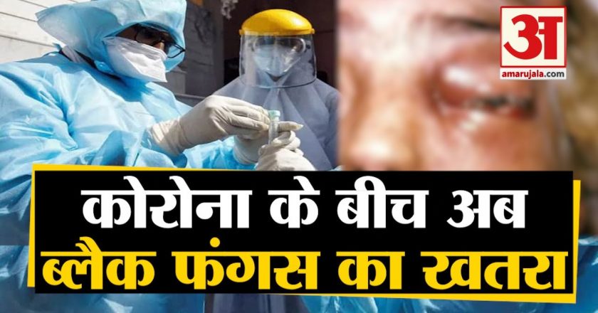 ब्लैक फंगल ने 5 दिन में छीनी आंख की रोशनी:कोरोना से ठीक होने लगे थे, सिरदर्द शुरू हुआ और रोशनी कम होने लगी; अब दूसरी आंख में संक्रमण का है खतरा