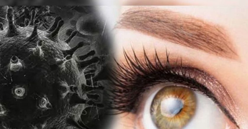 कोरोना के साथ ब्लैक फंगस से भी बचना है:10 राज्यों में 4536 केस, राजस्थान में प्राइवेट अस्पतालों में भी फ्री इलाज होगा