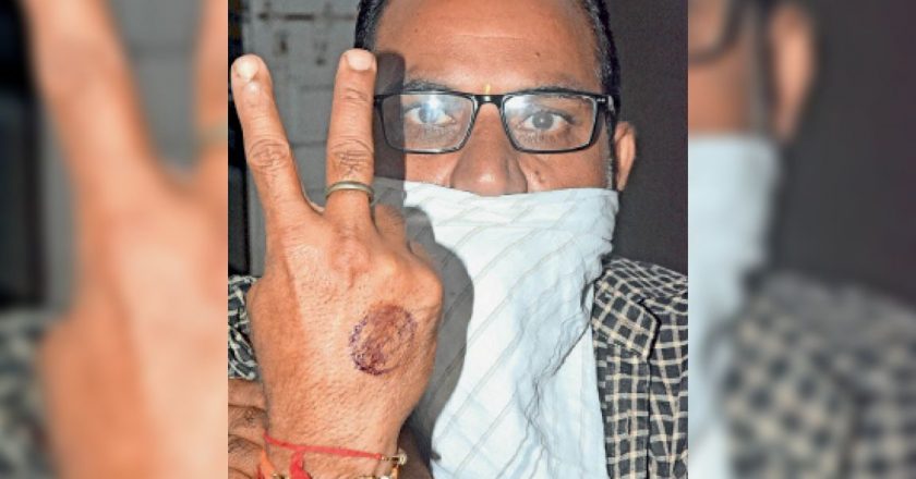 सुरक्षा का टीका:48 हजार डोज का लक्ष्य, 61412 को लगा, हाथ में पहली बार लगाया सिंगल, डबल टिक मार्क