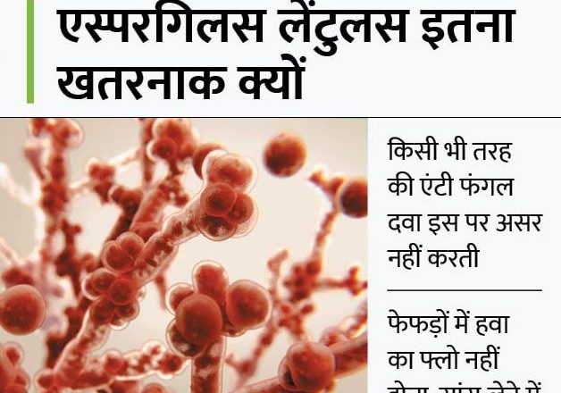 फंगस के नए स्ट्रेन से डॉक्टर भी हैरान:देश में पहली बार डिटेक्ट हुआ दवा को बेअसर करने वाला फंगस, दिल्ली AIIMS में 2 की मौत